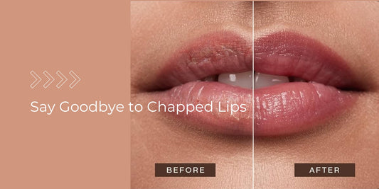 difference between chapped and fresh lips